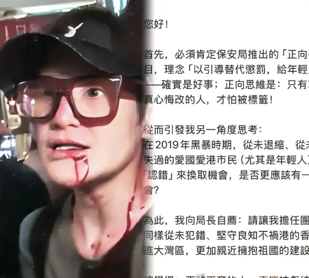 张敬轩翻车那阵子全网喊打，他低头道歉立马被包装成浪子回头典型。马蹄露在街头替