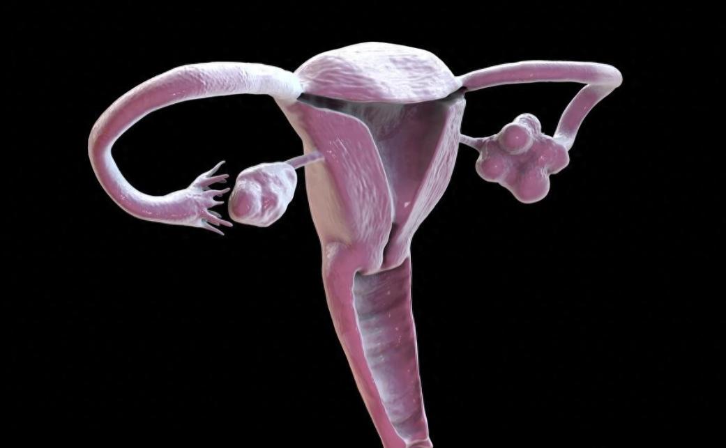 女性为什么会得“阴挺”？这3种因素，女性朋友要重视子宫位置出现下移或者脱