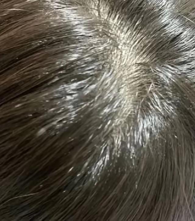 网上说洋葱皮染发纯绿色还自然，我还真试过，效果绝了！一开始刷到这个方法的时候，我