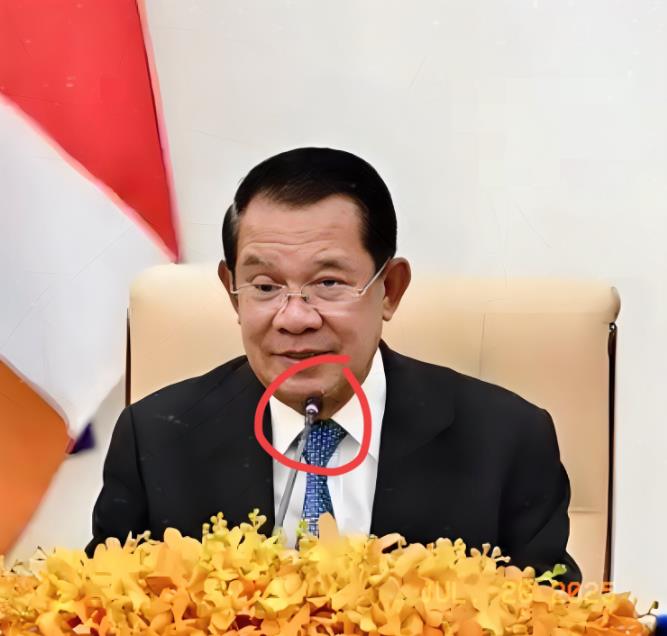 没法打！洪森开始紧张了！洪森知道泰国不怕他，因为泰国有60亿的国防预算，有