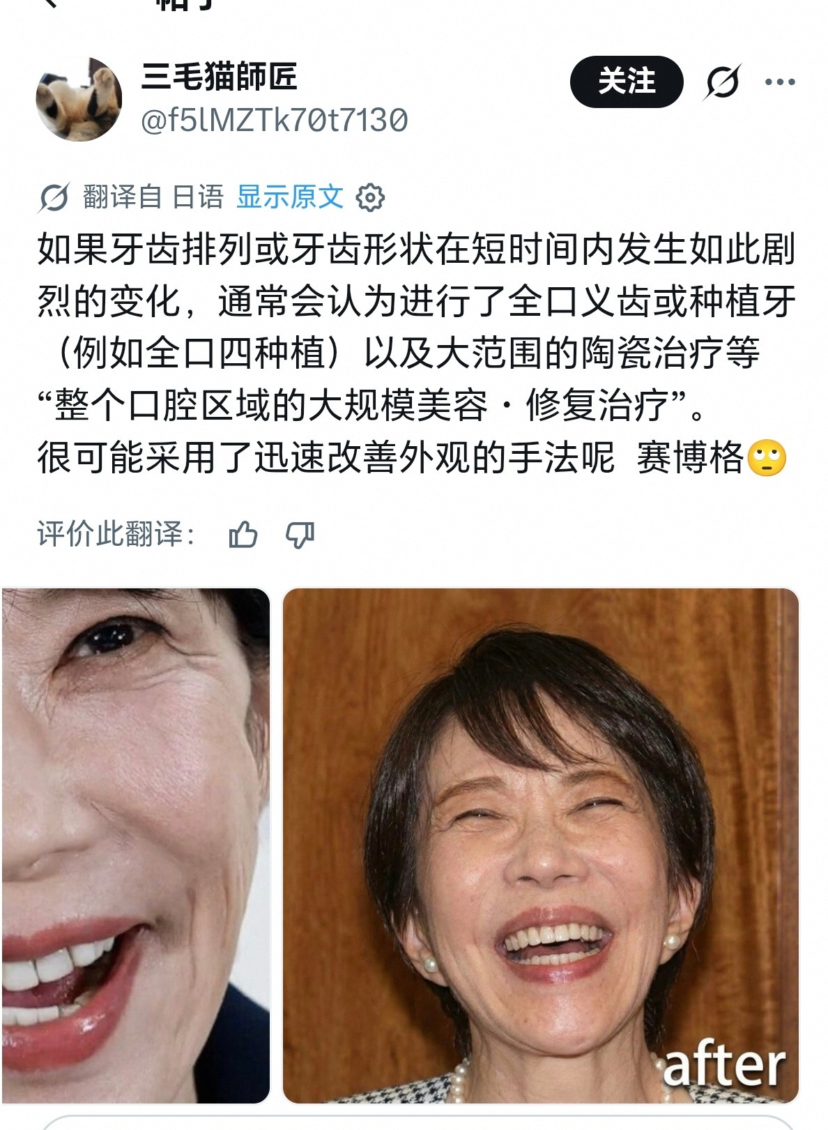 【慎点】日本网友怀疑高市早苗医美了，列出了医美前后的图。我实在是看不出区别……海