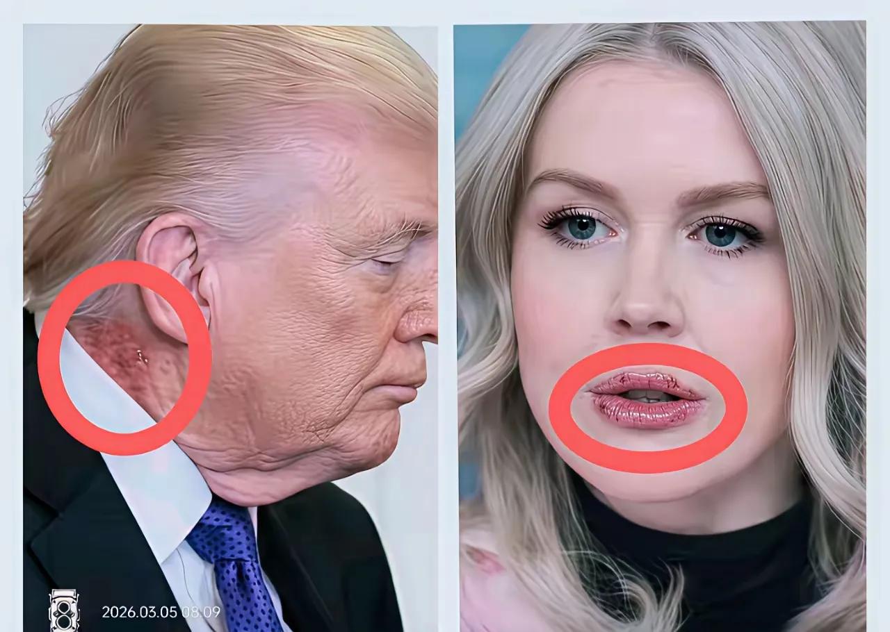 这是什么情况？两个人都上火了？