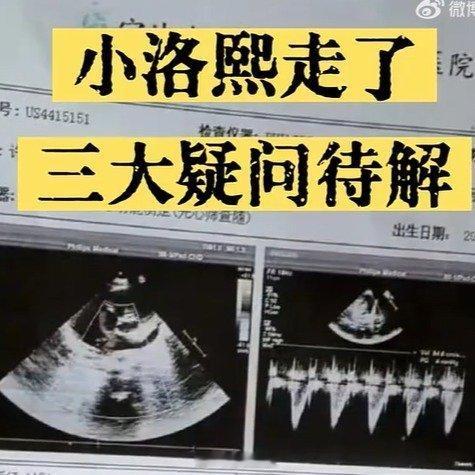 小洛熙事件调查惩前更要毖后我看今天上海瑞金医院的占世坤主任也对小洛熙主刀医生发出