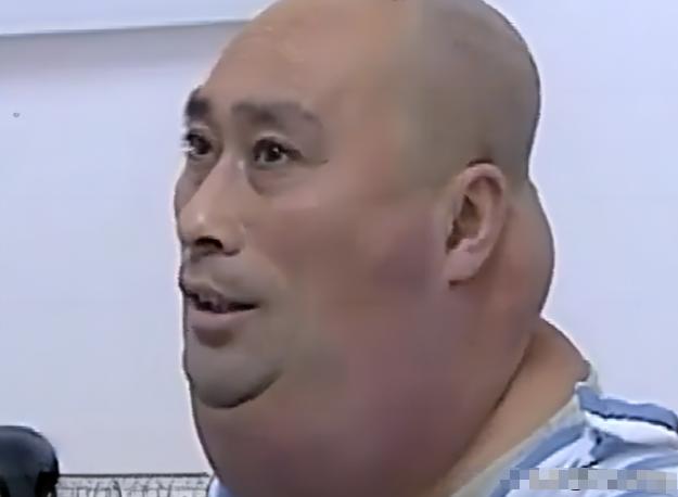 这也太吓人了，医生看了都直摇头，2013年末，东北李秋武把自己裹得严严实实的，来