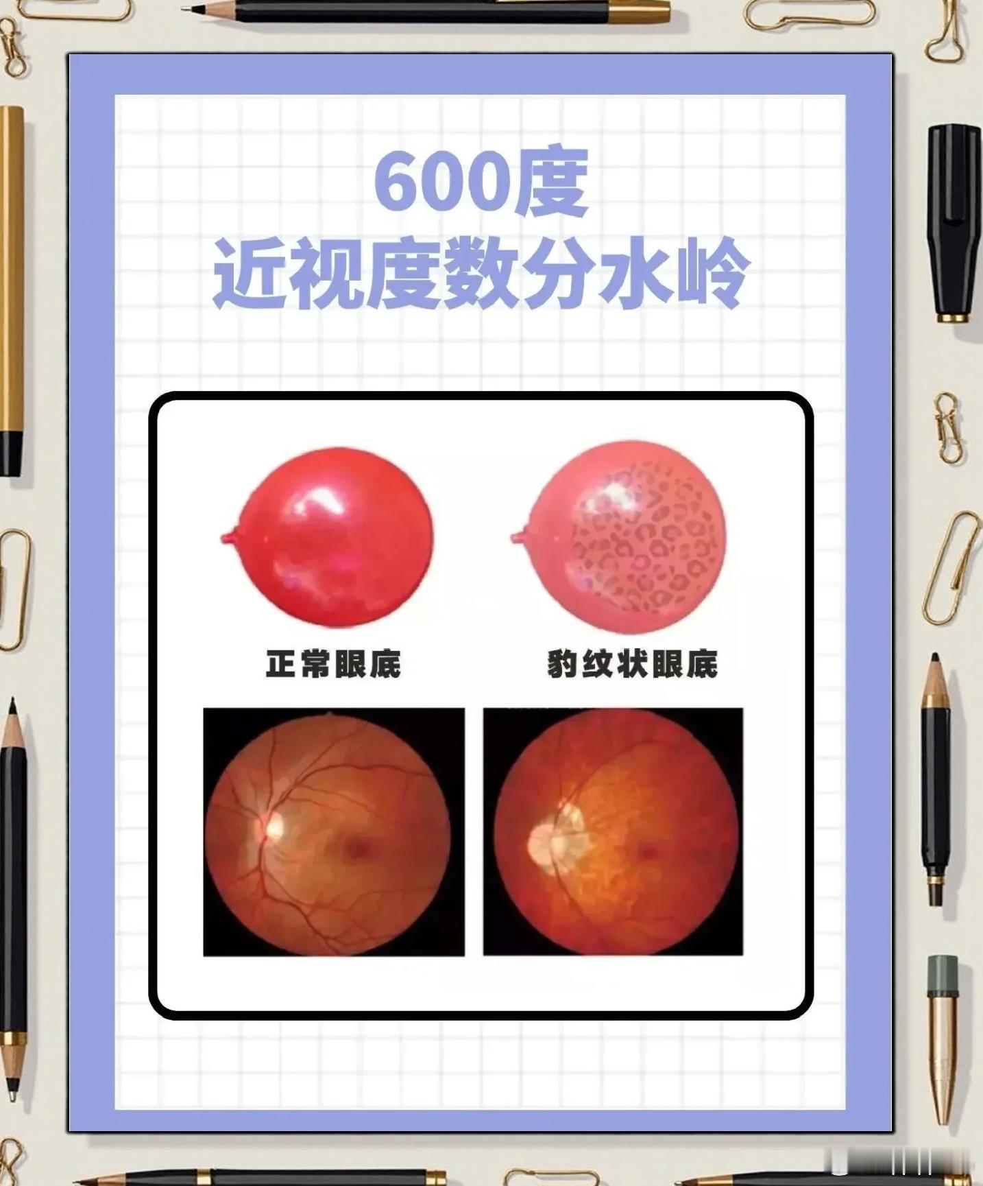 昨天带小朋友去配新的ok镜，顺便问了问医生晶状体植入、传统近视手术、白内障手术。