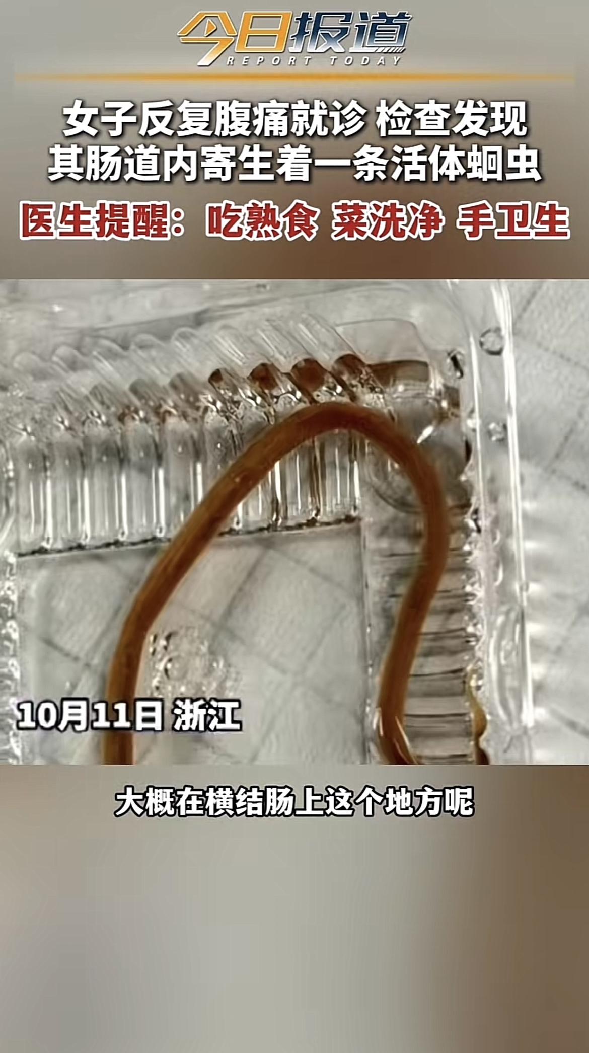 浙江金华，40多岁的女子肚子疼，以为是普通拉肚子，自己买了止泻药吃了三天，疼得反