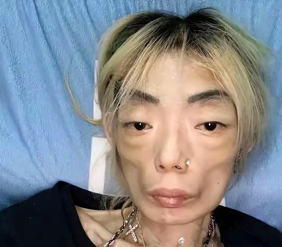 一代女神沦为豪门玩物：结婚8年牙齿全掉，器官切除，面似骷髅