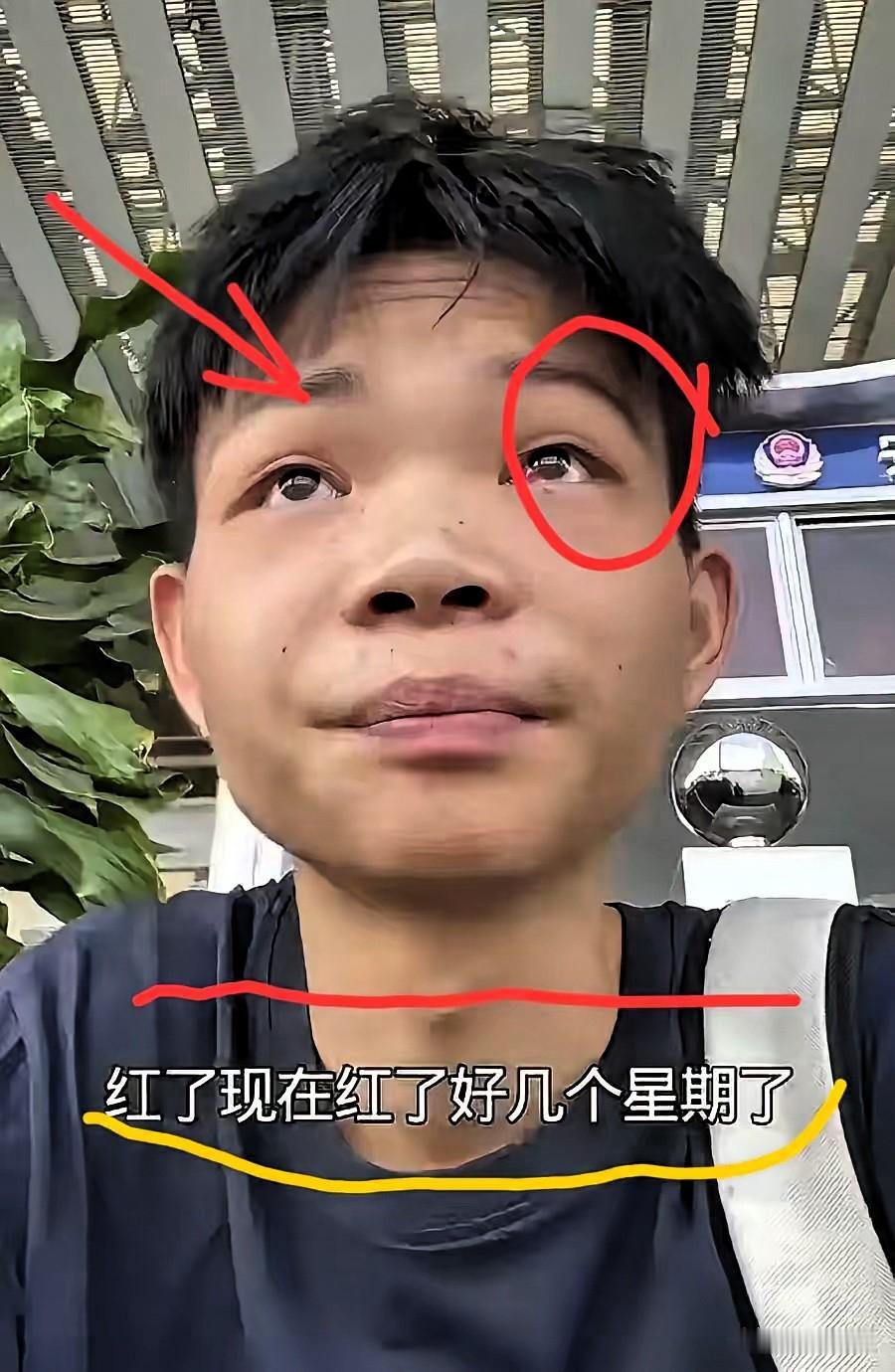 “烤鸡少年”哭丧着脸的样子，与其说是流量反噬的狼狈，不如说是急功近利的必然！