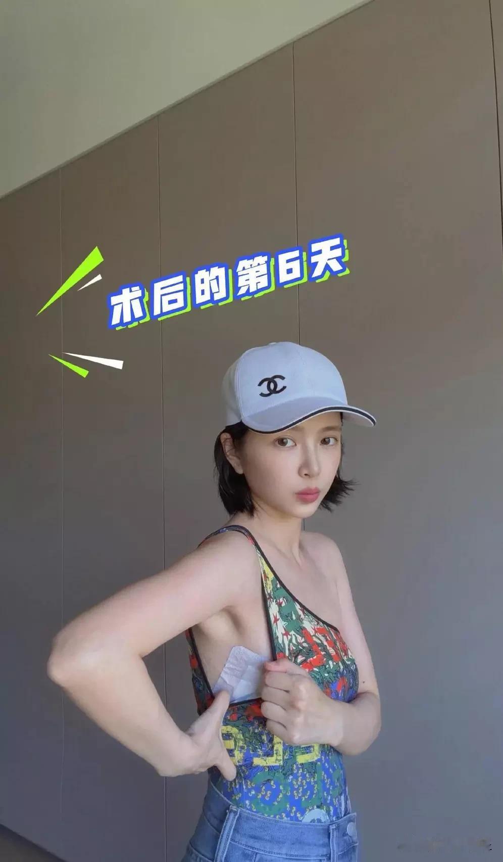 杜淳妻子王灿自曝因肺部感染延误治疗，切除部分肺叶后已顺利出院。她乐观报平安，称手