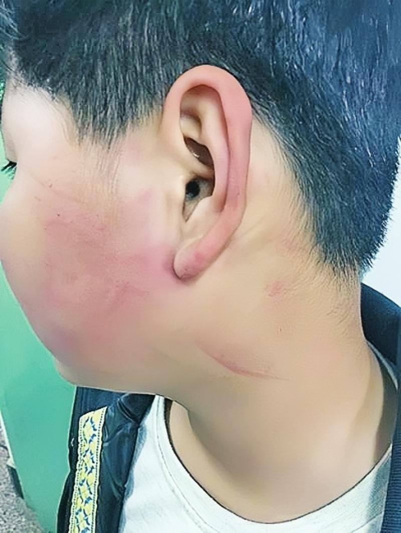 2019年，四川一名校长，因学生调皮，扇了他几巴掌，被孩子母亲逼着赔礼道