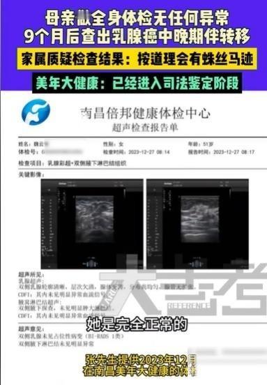 江西南昌，男子的母亲感觉右乳不舒服，就去做全身检查，医生给出报告说是没啥问题。结