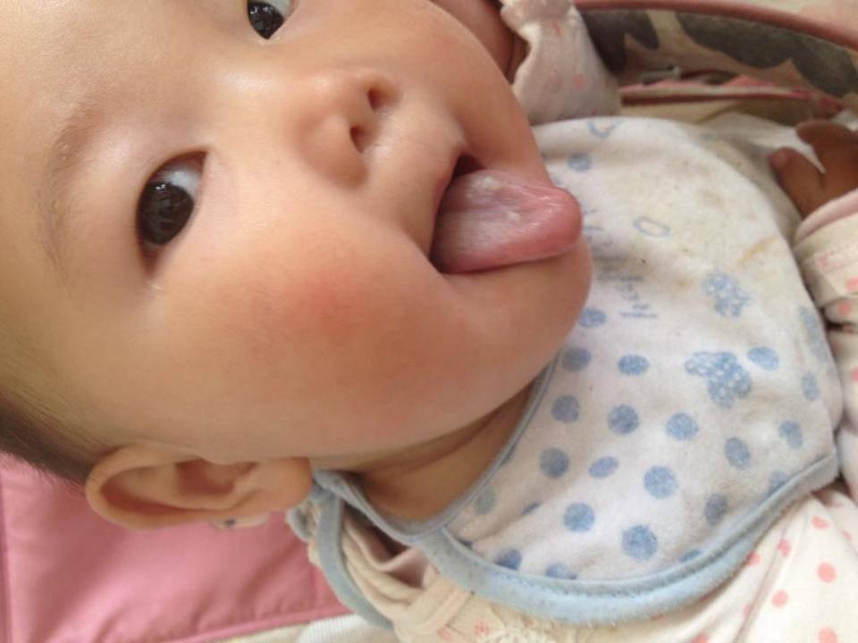 宝妈一碗汤~孩子积食从不慌, 一次就拉, 1周长高3cm