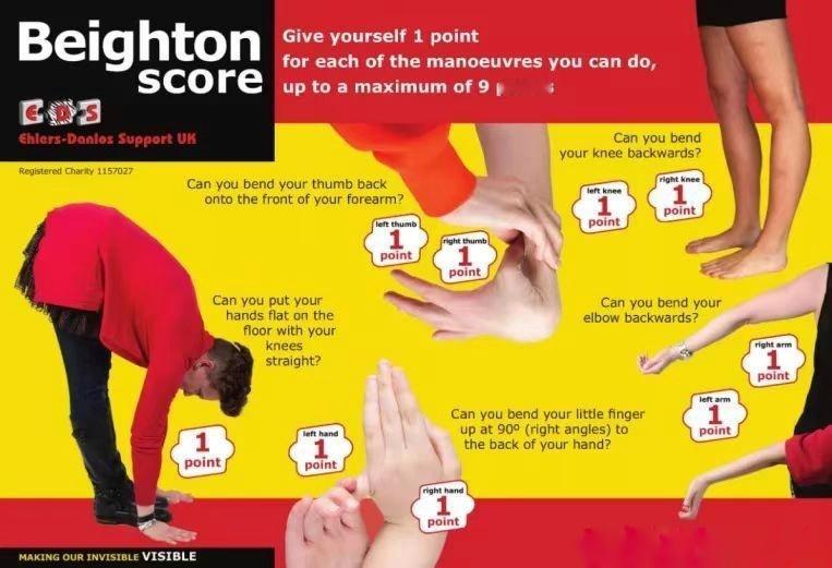 韧带松弛昨天有朋友提问：怎么测试自己有没有韧带松弛？今天来教大家一套简单的评估