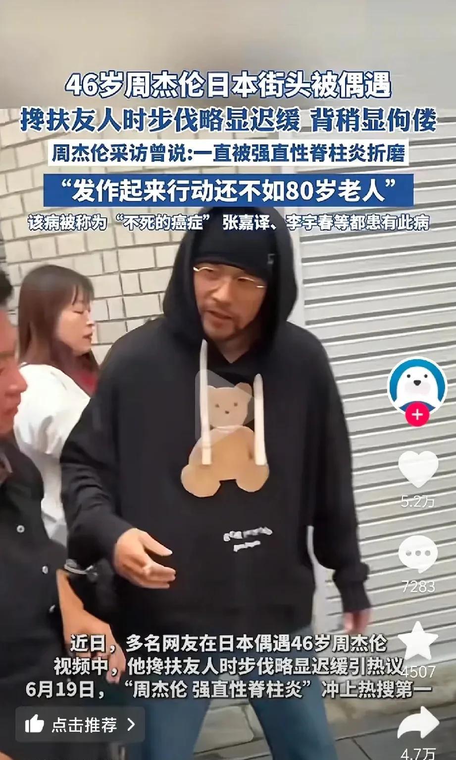 我想问杰伦这个病真的这么严重吗？怎么衰老成这样？我就说杰伦这个强直性脊柱炎会不