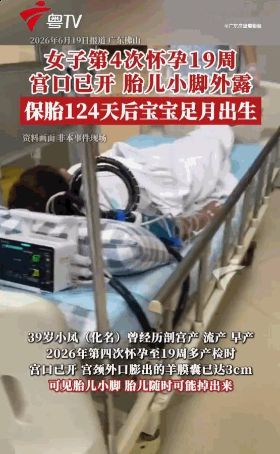 “希望母子平安！”广东佛山，一位39岁的高龄产妇，在怀孕19周时，宫口竟然已经大