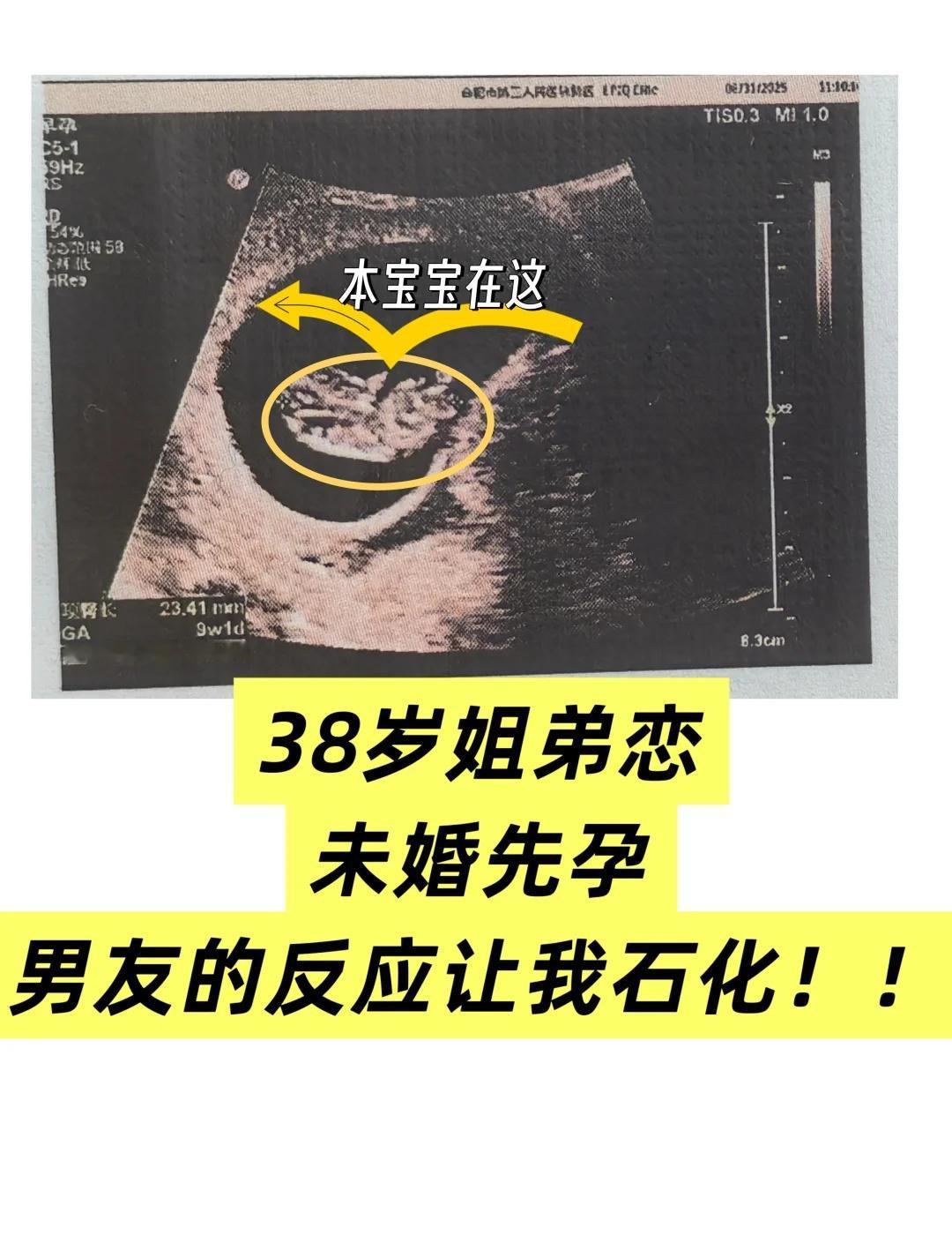 🤰38岁姐弟恋怀孕，男友的反应让我石化！在没有更新的日子里，我偷偷干了一件大