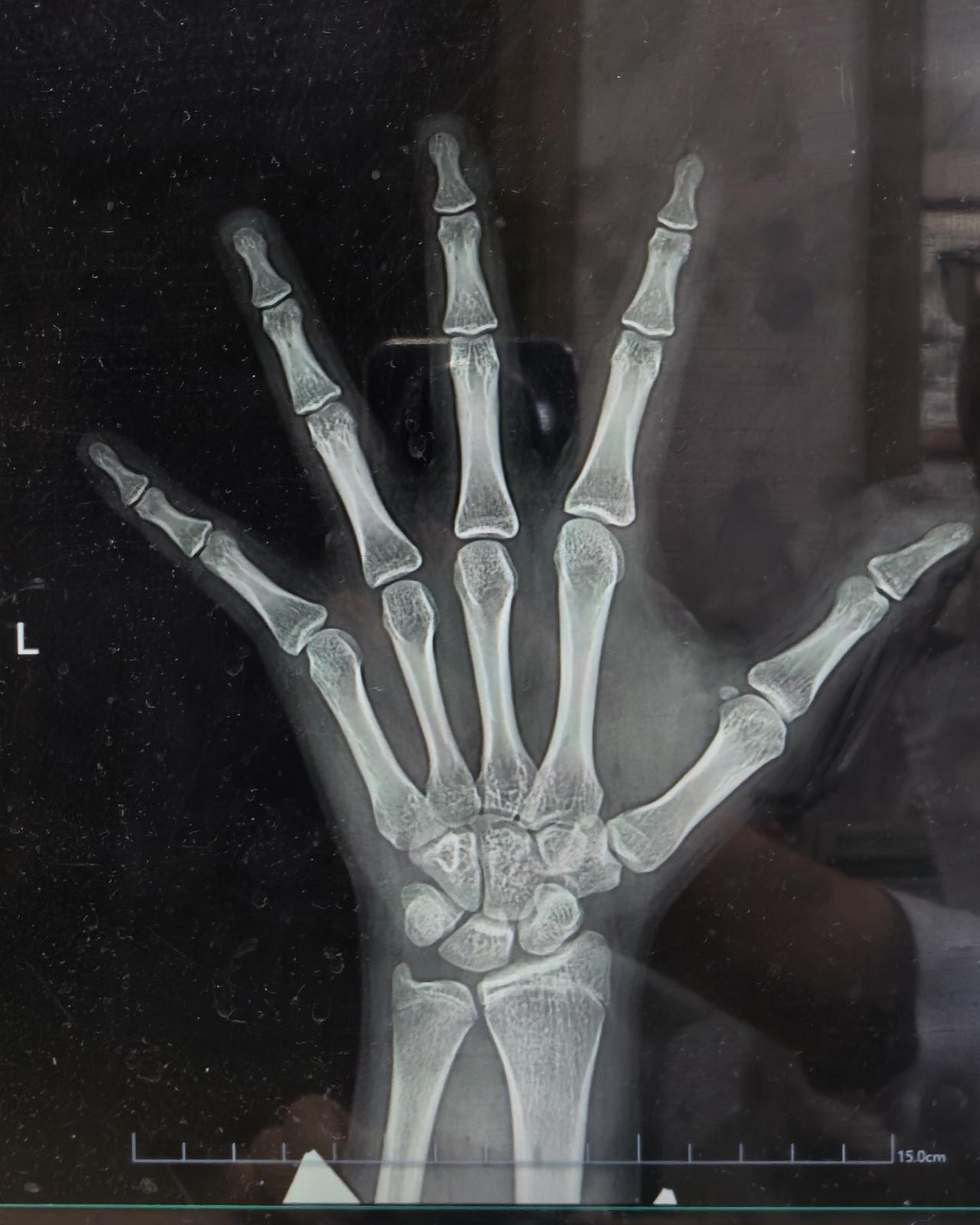 遗传身高不突出，青春期又不延迟，家长又对孩子身高感到焦虑，或者对孩子的职业方向规