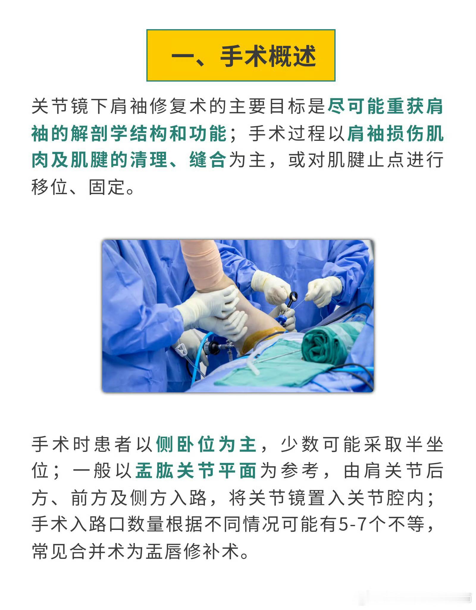 肩袖术后怎么康复肩袖损伤是导致肩关节疼痛和功能受限的常见原因，而肩袖撕裂或断裂
