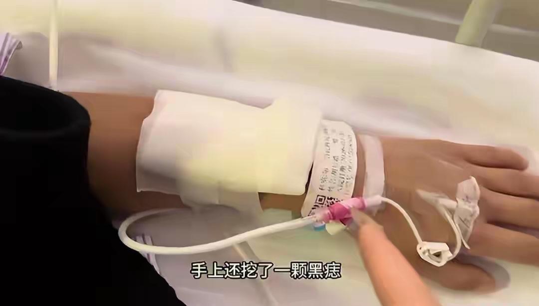 29岁男子一周内连做痔疮、包皮环切、肠息肉切除、拔智齿等五场手术，术后直呼太遭罪