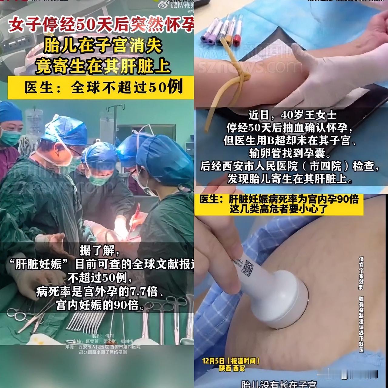 最担心的事出现了陕西一名40岁女子抽血显示自己怀孕了，但子宫里却找不到胎儿！