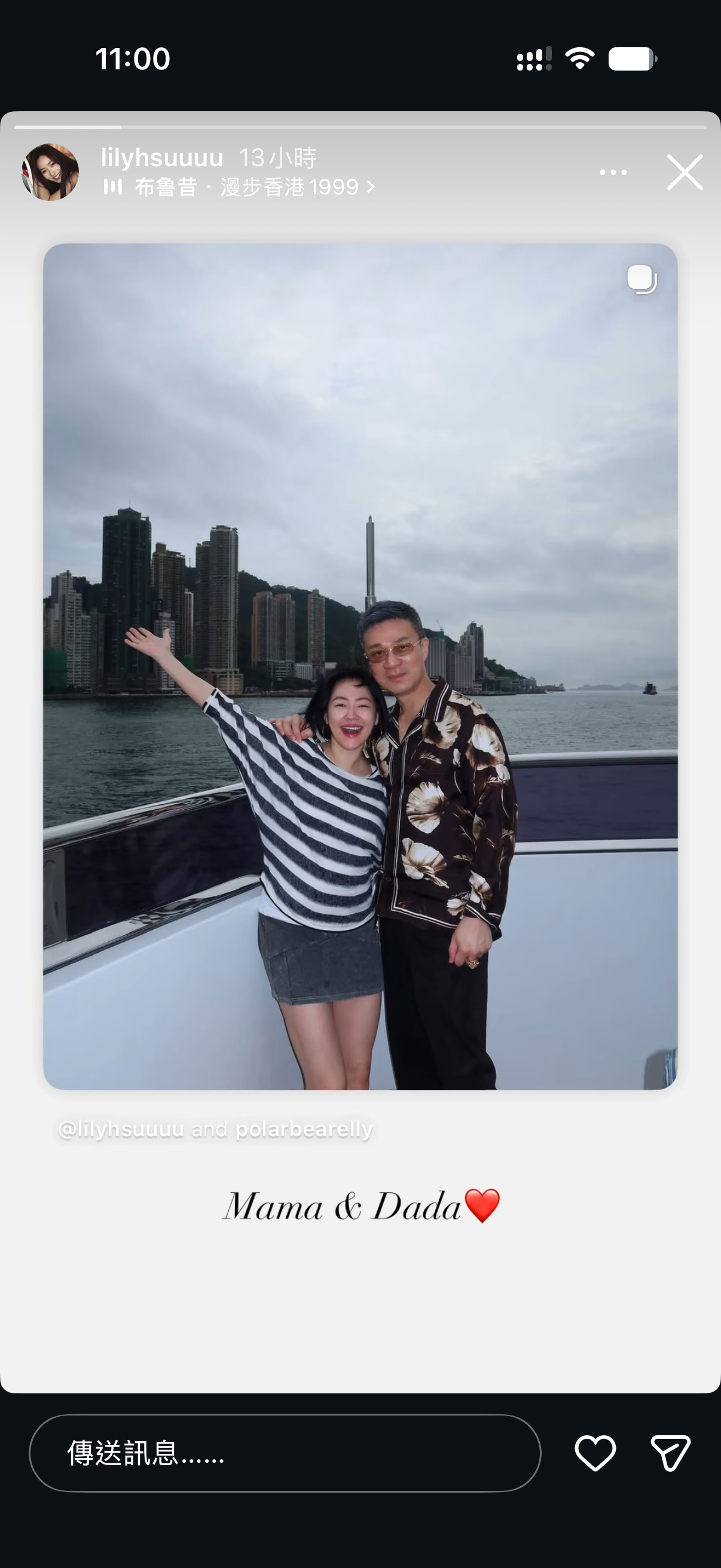 小S帮老公Mike澄清白头发：「我老公要我帮他说，他不是白发，是他以时尚眼光买了