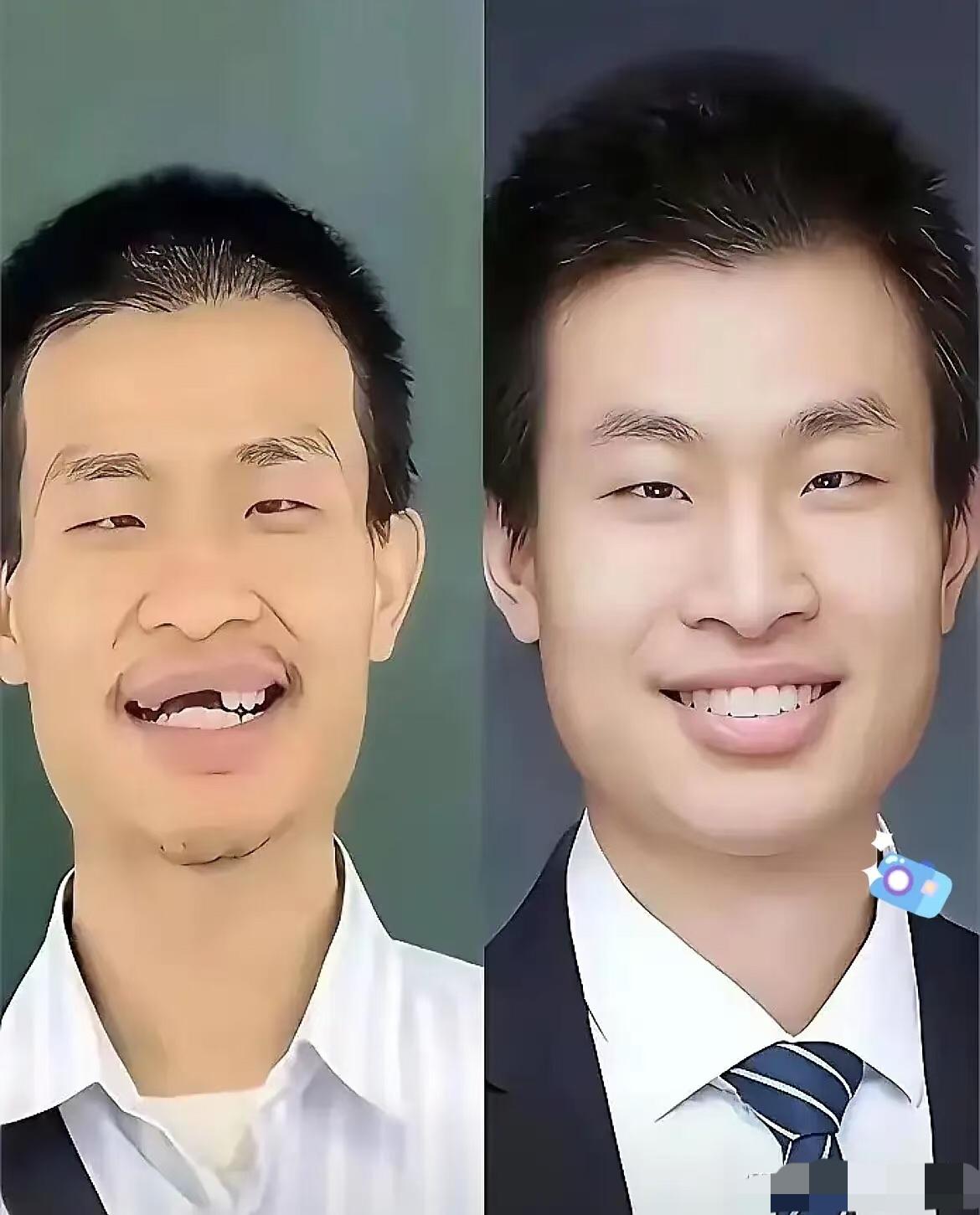 韦东奕被反超！！！北大韦神，三十多了，在北大刚刚评上副教授，到目前为止，还没