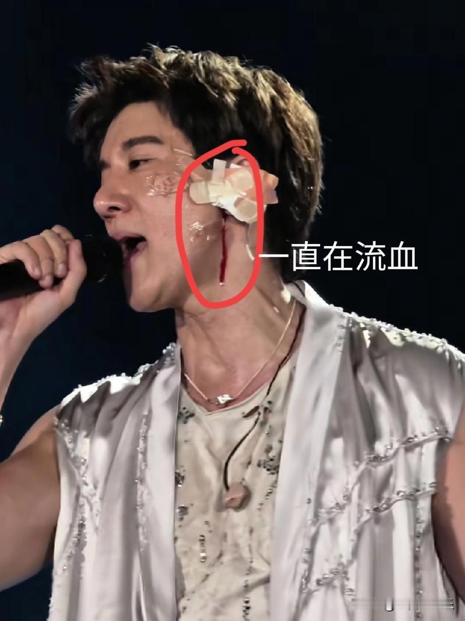 跟一个律师朋友聊天，他说王力宏摔的血流不止坚持唱完，根本不是因为敬业，而是