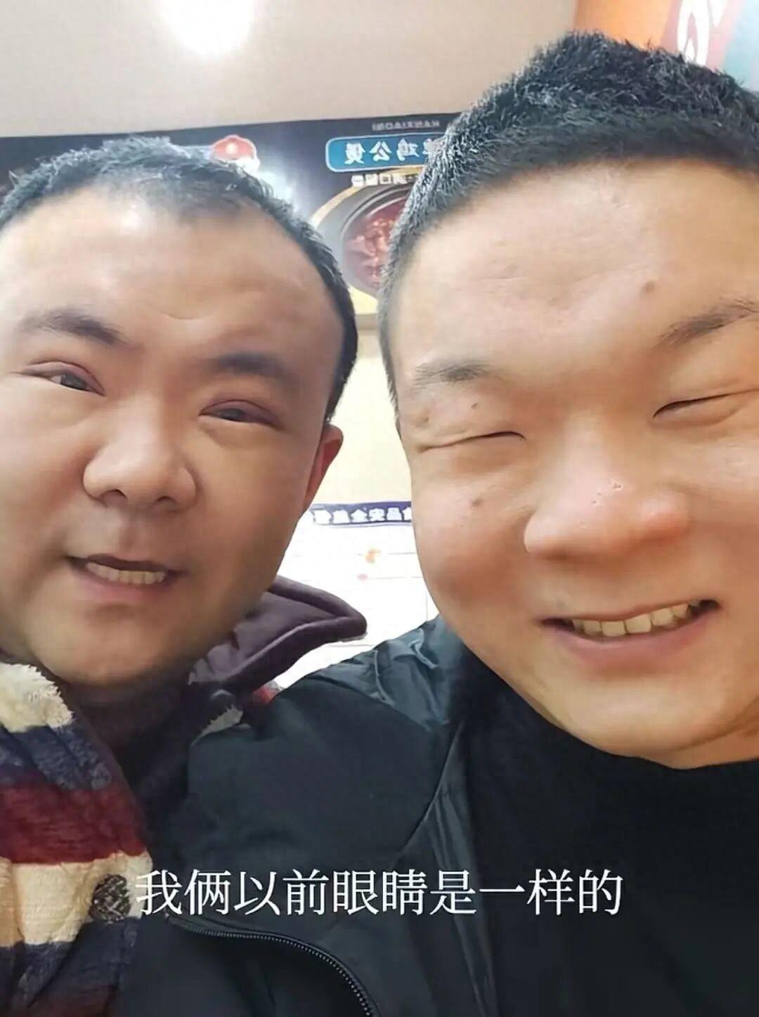 笑不活了！河南开封，一对双胞胎哥俩眼睛都比较小，当大哥的想着改变一下外观，就拉着