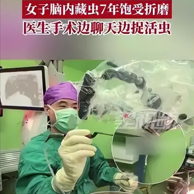颅内藏虫存活7年！女子清醒开颅，医生靠聊天活捉元凶你敢信？一名女子大脑里，竟