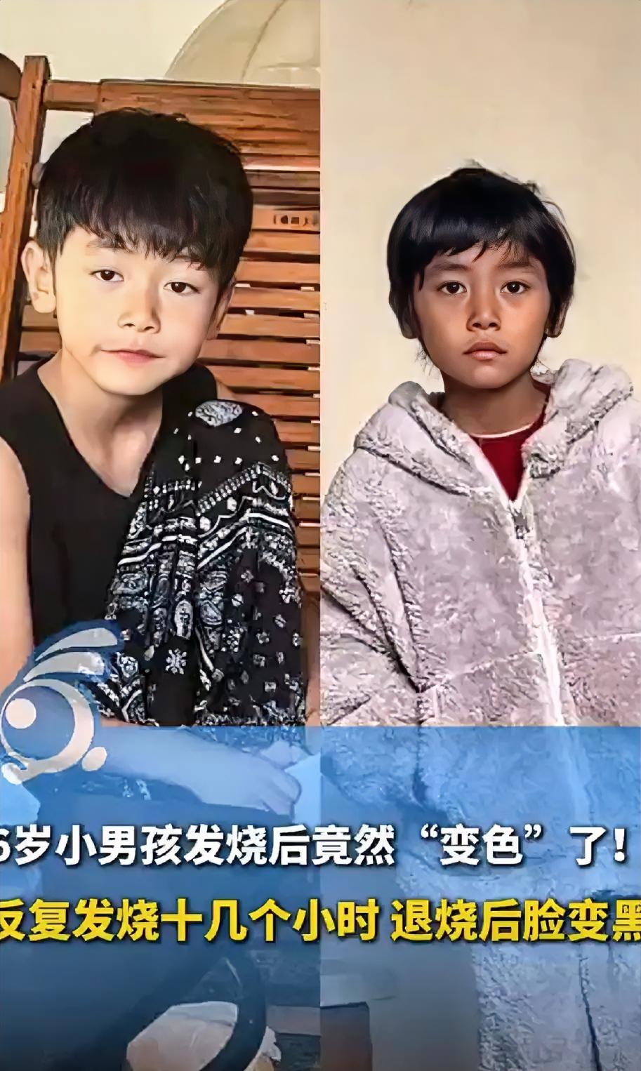 孩子都懵了，妈妈也懵了，他们没想到，发个烧还会改变肤色，虽然说是发烧了十多个