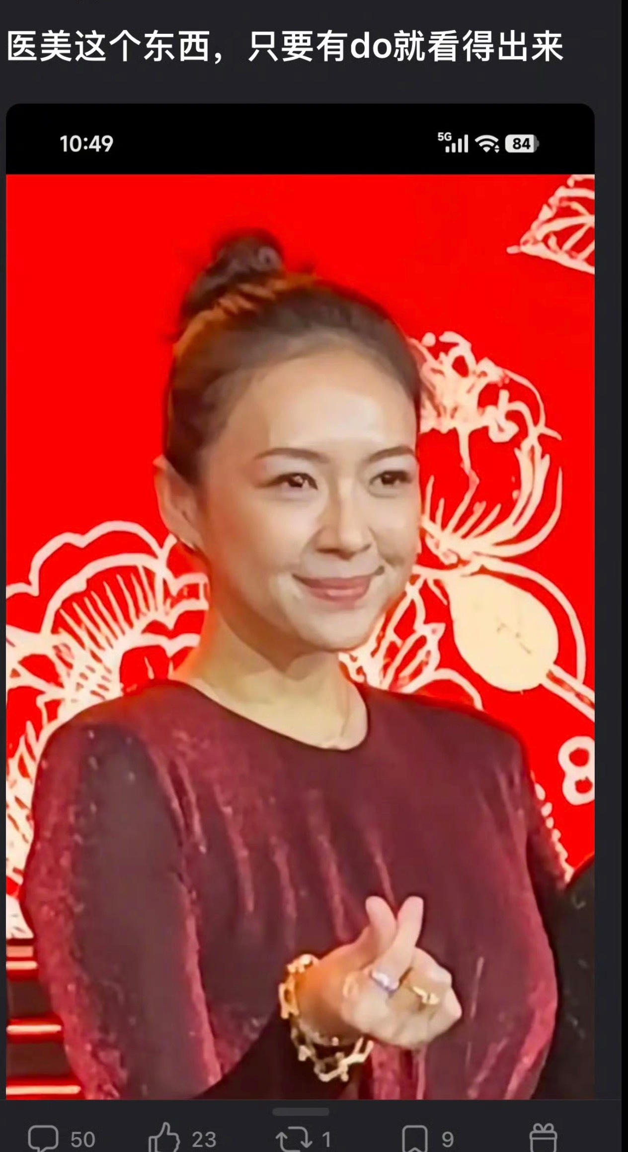 网友热议章子怡的脸能看出医美痕迹很重嘛？