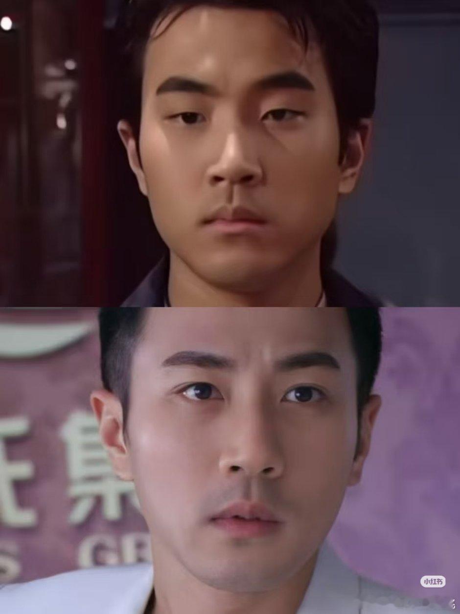 他俩这双眼皮割的很有必要