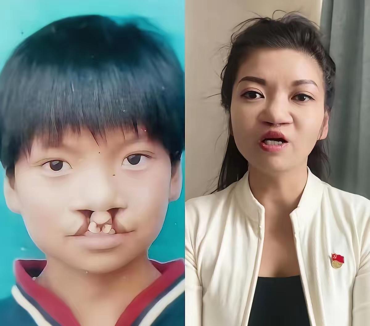 刷到那个女孩的直播时，我盯着屏幕看了很久。她说话有点漏风，是重度唇腭裂修复