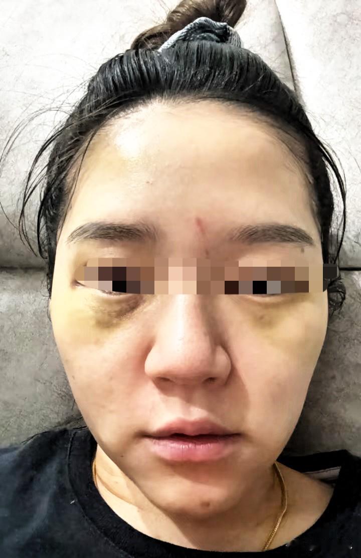 我妈打了怀孕的老婆，我没说话，第二天一大早我直接把她送去养老院。养老院每月4