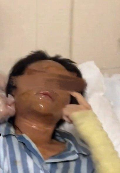 湖南一女主播收到炸弹包裹被炸伤地址信息被知晓，这种事很难防范，投放炸弹这种事真的
