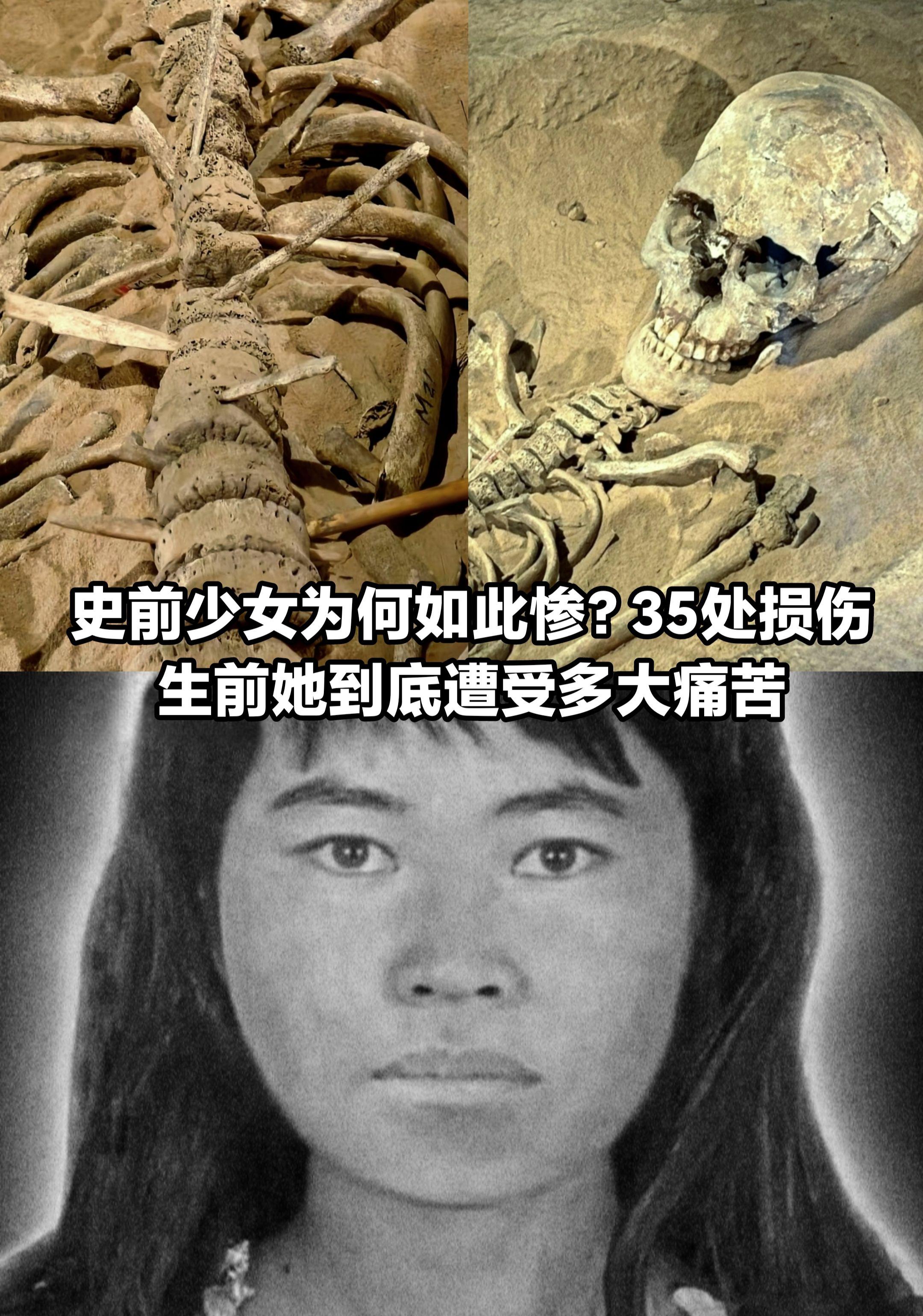 考古发现最惨史前少女，身上35处损伤。