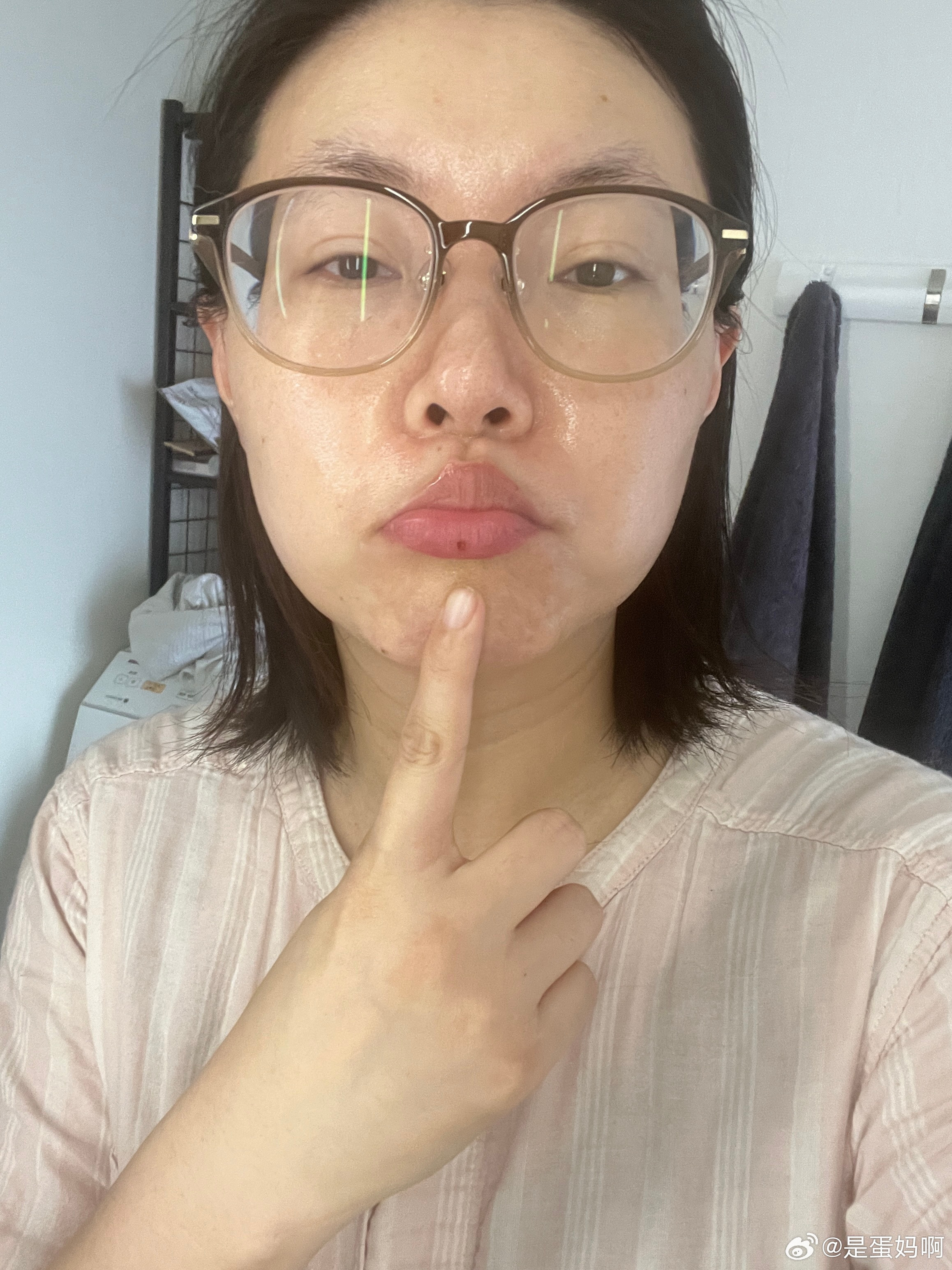 吃包子被烫的