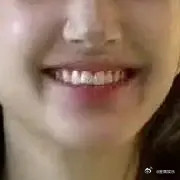 赵露思这人中也歪的太严重了吧不去弄一下？老粉是不是已经见怪不怪了