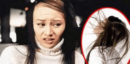 生发小妙招, 脂溢性脱发怎么办?