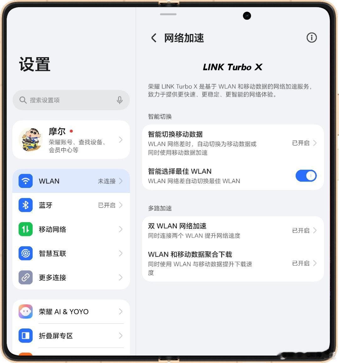 荣耀MagicOSOS双WLA和Wlan+移动网络加速太实用真的很喜欢荣耀Mag