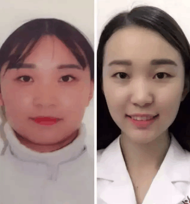 当你减去20斤脂肪,身体会各部位发生哪些奇妙的变化?