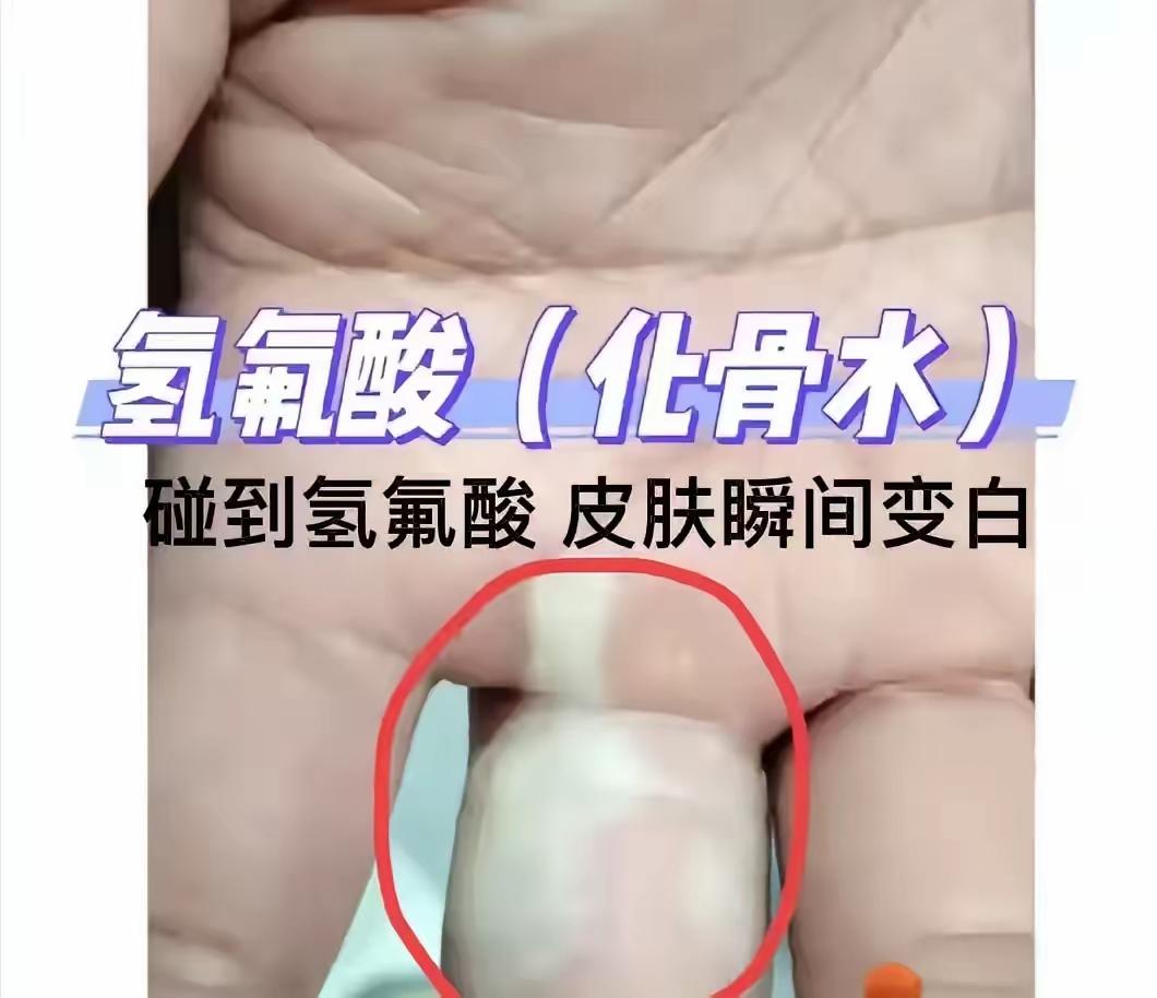 化骨水有多厉害？上午9点不小心踩到，下午3点心脏衰竭，5天后不幸去世……最近