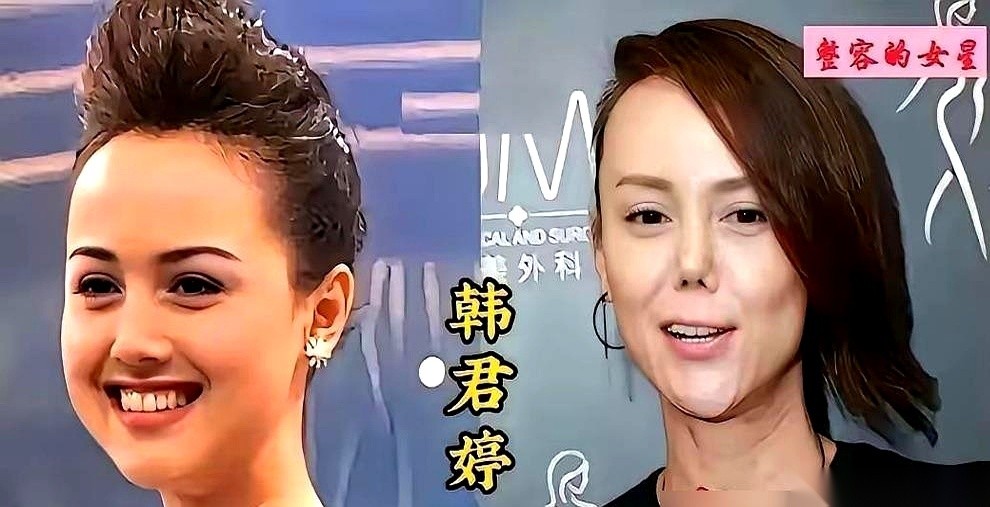 《延禧攻略》里“纯妃”这个角色，原本的底牌是张檬。合同都已经走到最后一步了，偏偏这时候，制片人于正去