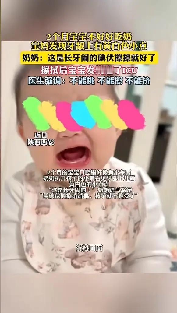 陕西西安，一女子发现自家孩子牙龈上有几颗黄白小点，孩子奶奶以为上火了，就沾上碘伏