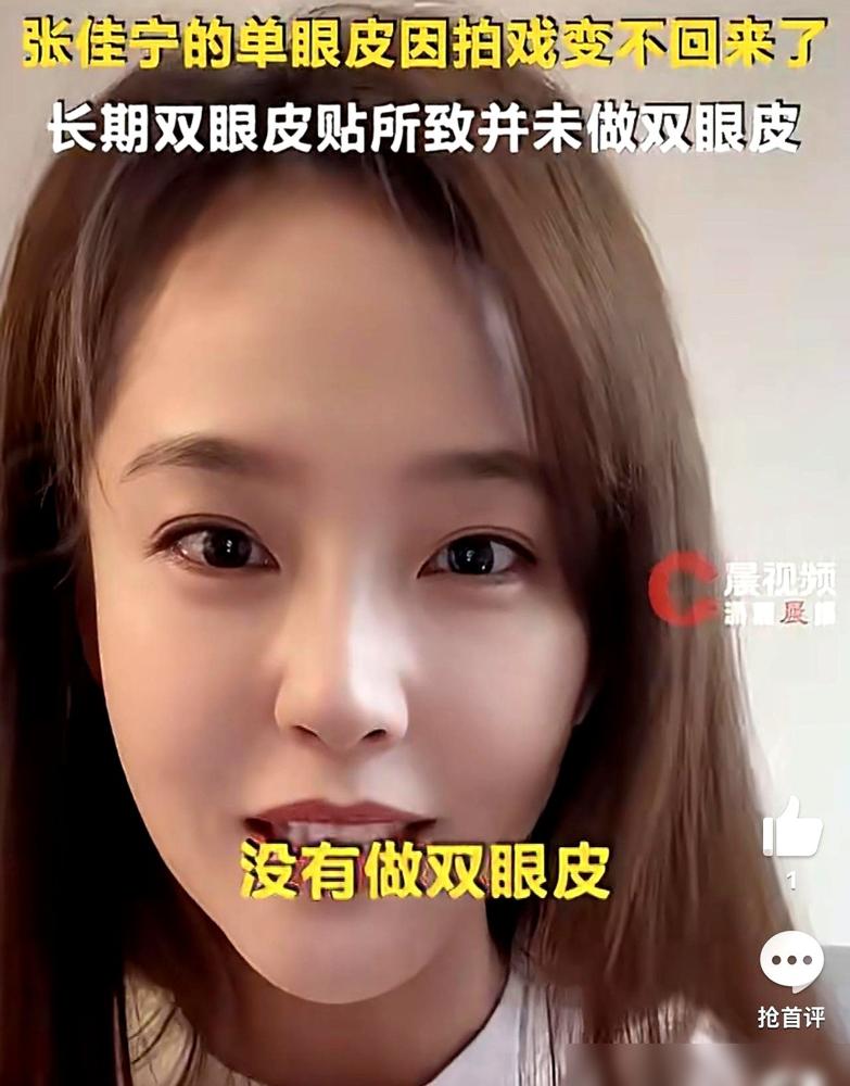 张佳宁一句“眼皮贴松了”，直接把那些说“拔牙换脸”的女明星，干沉默了。人家拍