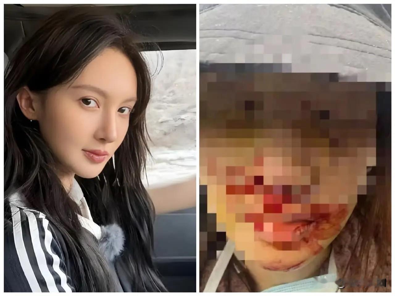 金晨肇事逃逸真相大白，警方通告助理顶包为事实，金晨晒出车祸现场照片并道歉，造成车