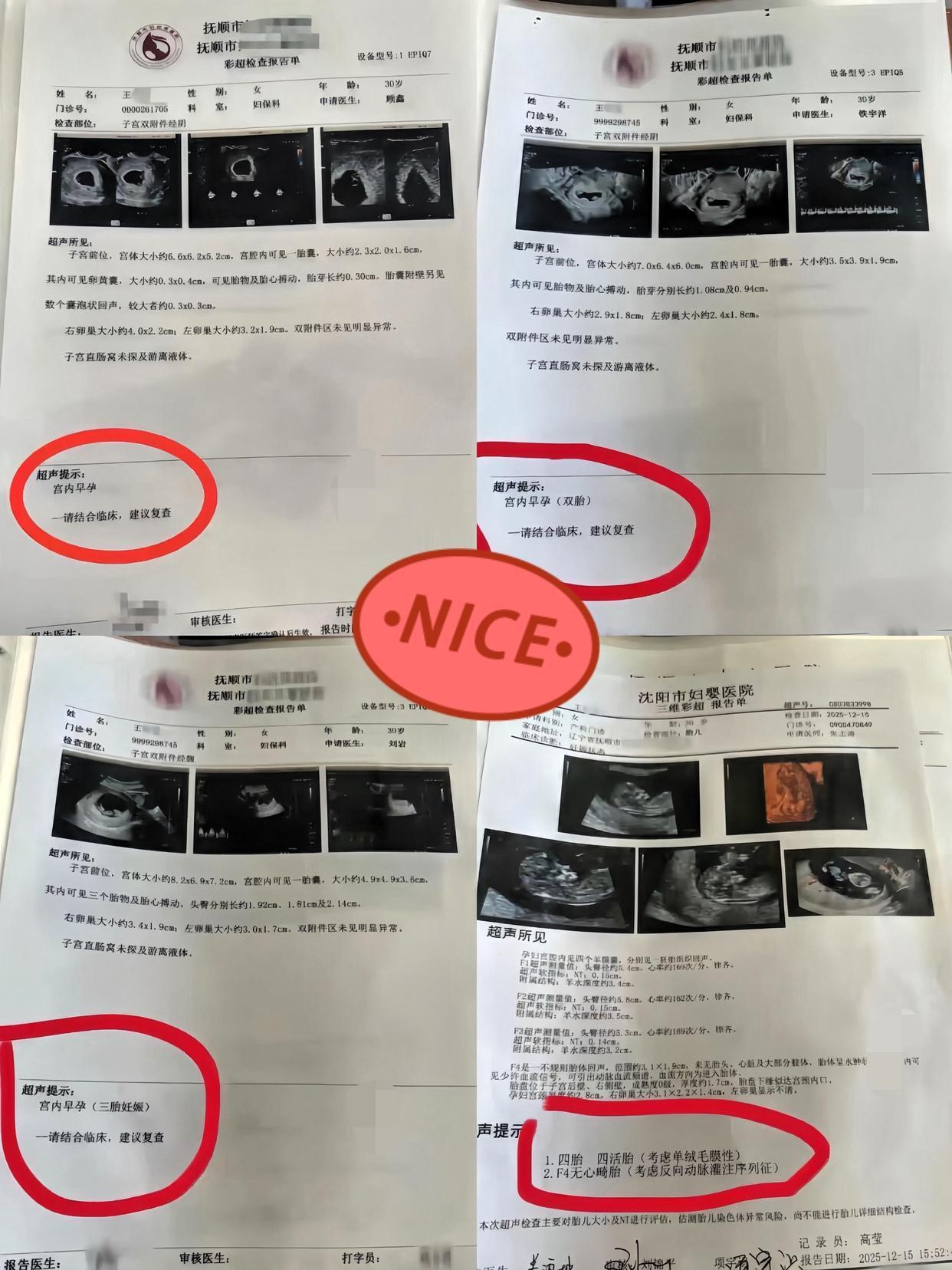 解释不清了！辽宁抚顺的王女士，怀孕后产检经历堪称“神奇大片”。30岁的她