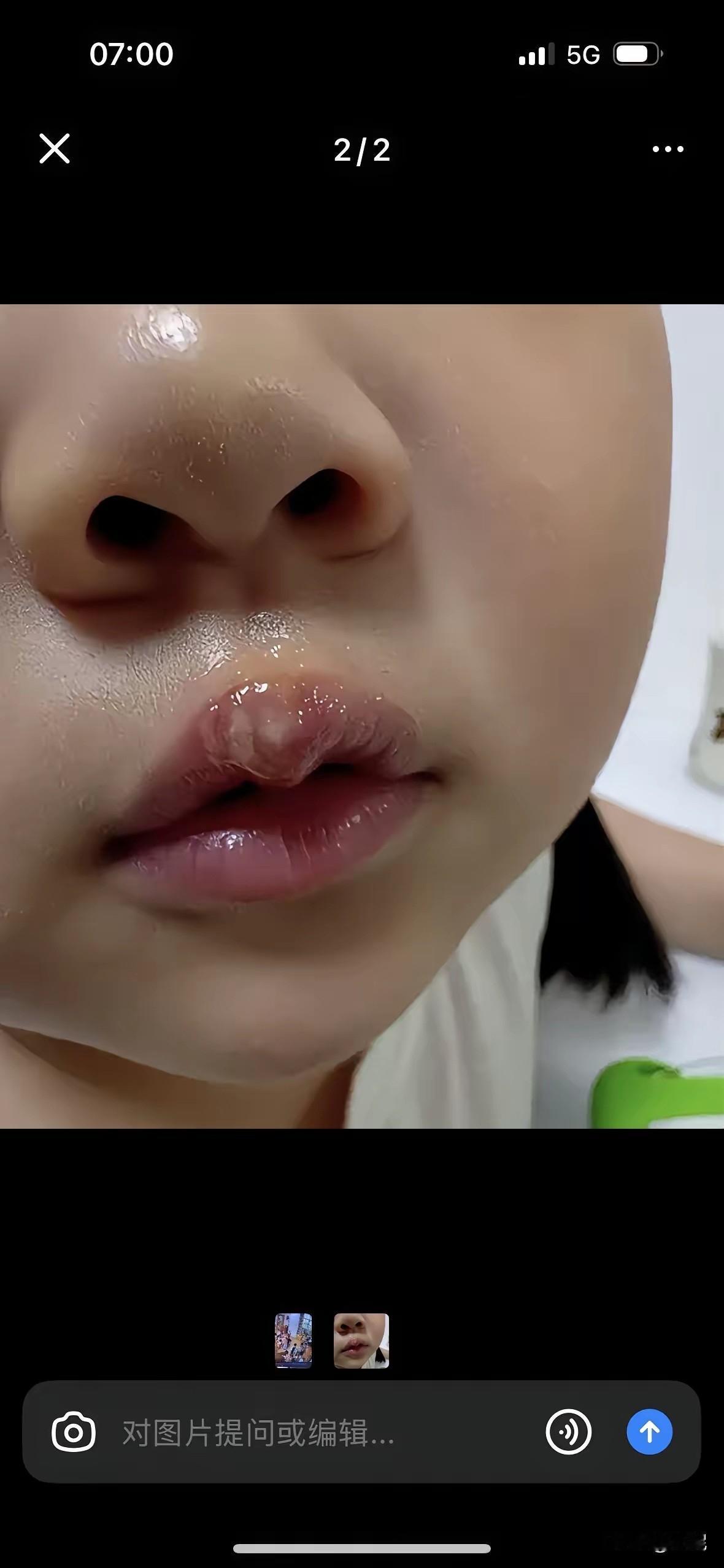 江苏丰县机关第二幼儿园的这位陈老师,这回是真栽了。她用热熔胶棒烫孩子嘴唇的监
