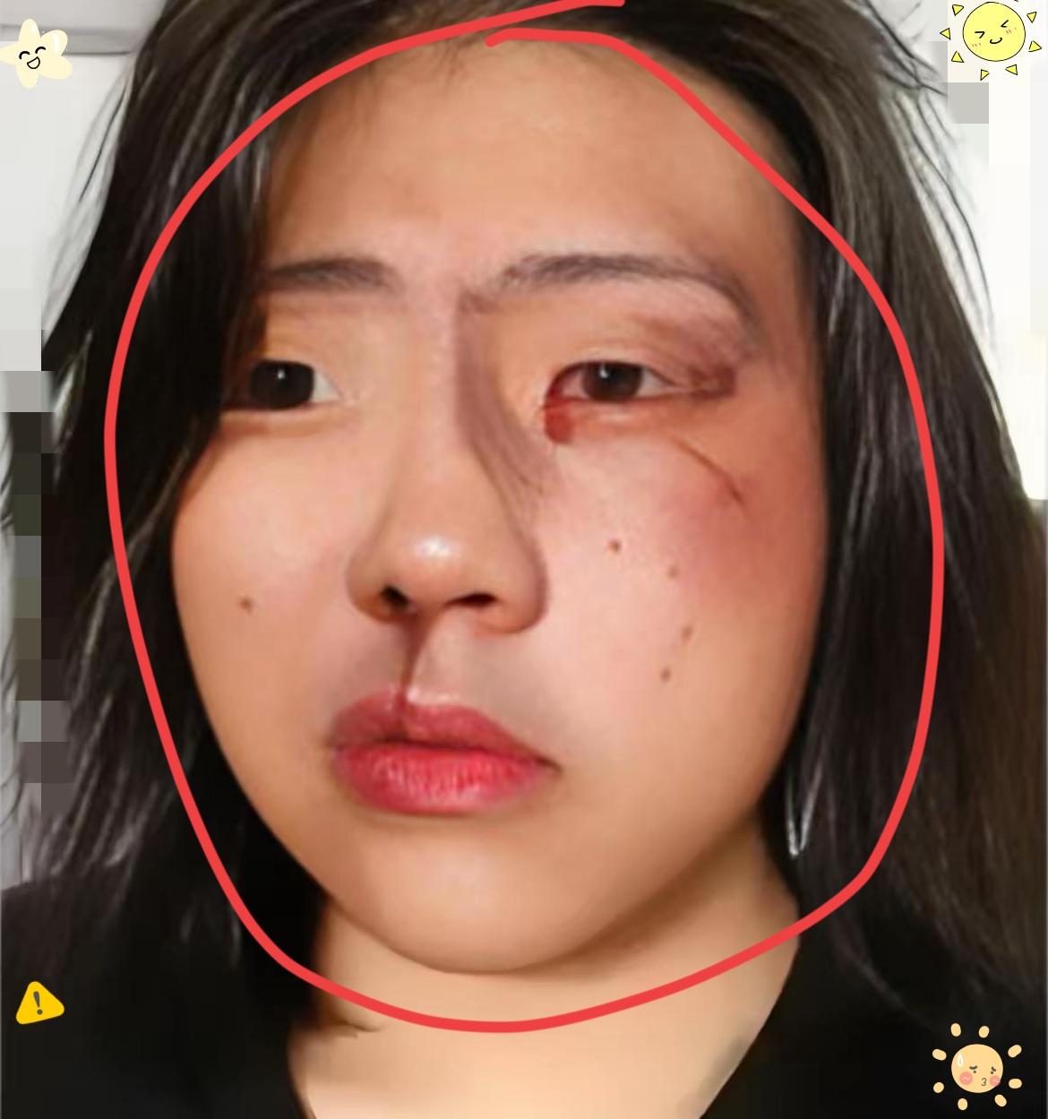 谁能想到高高兴兴去九寨沟旅游，最后竟带着一脸伤回家？有个女生入住酒店时，发