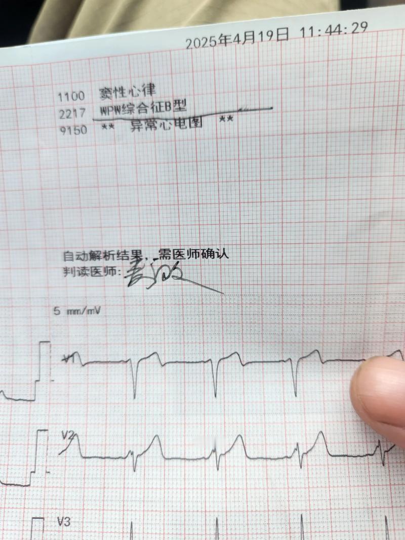 心脏好不好，先看7个指标，再看4个地方舒服不舒服心脏疾病大多隐匿发病，突发心梗